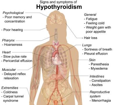 b2ap3_thumbnail_Signs_and_symptoms_of_hypothyroidism1.jpg